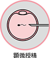 顕微授精(ICSI)